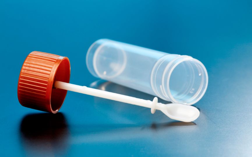 Recipiente para recogida de una muestra de heces para análisis coprológico
